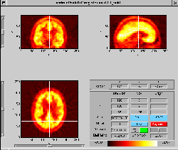 \includegraphics[width=0.45\textwidth]{images/ips_slice3_res.ps}