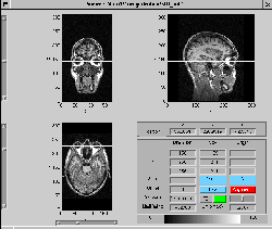 \includegraphics[width=0.45\textwidth]{images/ips_slice3_std_eye.ps}