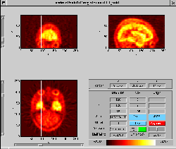 \includegraphics[width=0.45\textwidth]{images/ips_slice3_res_eye.ps}