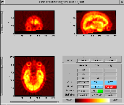 \includegraphics[width=0.45\textwidth]{images/ips_slice3_res_aligned.ps}