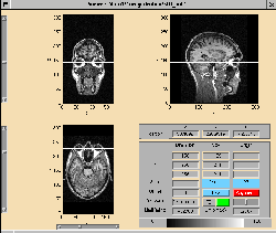 \includegraphics[width=0.45\textwidth]{images/ips_slice3_zoomstate.ps}