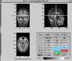 \includegraphics[width=0.45\textwidth]{images/ips_slice3_std.ps}