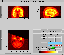 \includegraphics[width=0.45\textwidth]{images/ips_slice3_err_project.ps}