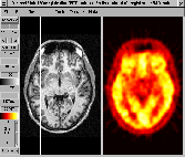 \includegraphics[width=0.3\textwidth]{images/inspect_sideways_axial.ps}