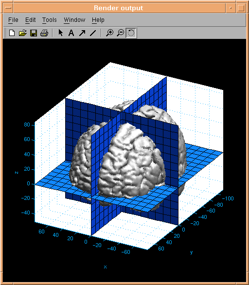 Brain surface passing through the 8 octants