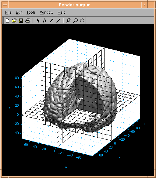 Brain surface passing through the 8 octants. Octant 2 opened.